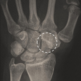 Radiograph
