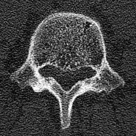 CT