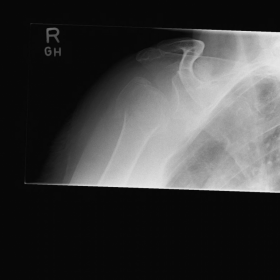 Plain radiograph