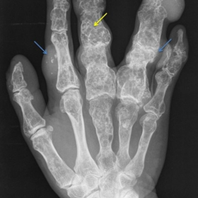 Hands