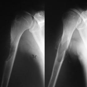 Radiography