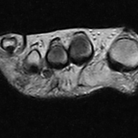 MRI - Axial Plane