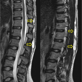 MR imaging, T2W