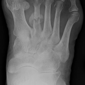 X-Ray